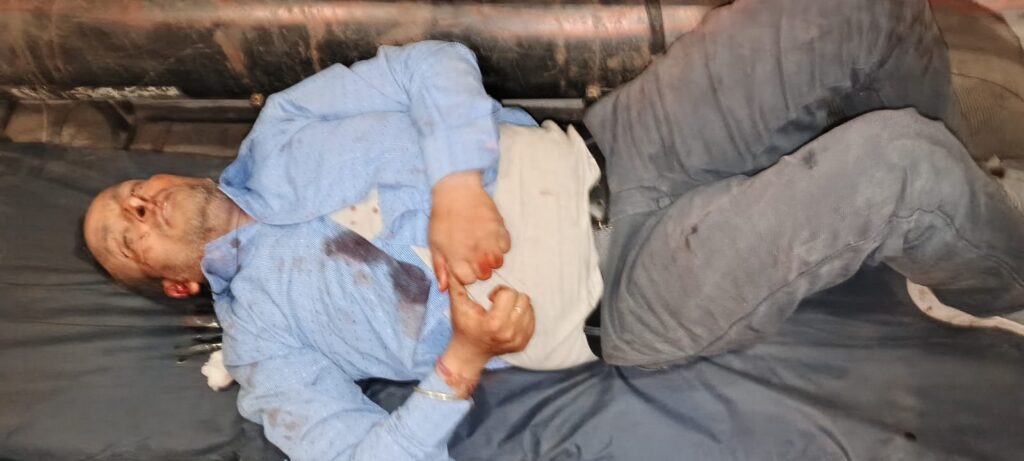 बहसूमा: सदरपुर गांव के पास बाइक फिसली, युवक घायल, पुलिस और एंबुलेंस टीम ने पहुंचकर पहुंचाई मदद