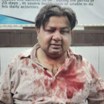 मवाना में फोटोग्राफर पर लूट के इरादे से हमला, घायल होने के बावजूद किया मुकाबला