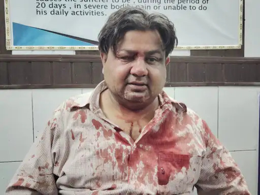 मवाना में फोटोग्राफर पर लूट के इरादे से हमला, घायल होने के बावजूद किया मुकाबला